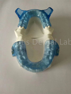 बेहतर दांत संरेखण परिणामों के लिए उन्नत Orthodontics उपकरण